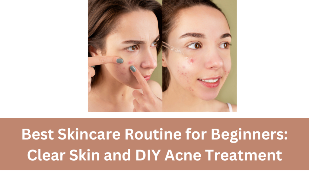Best Skincare Routine for Beginners: Clear Skin and DIY Acne Treatment Best Skincare Routine for Beginners: Clear Skin and DIY Acne Treatment